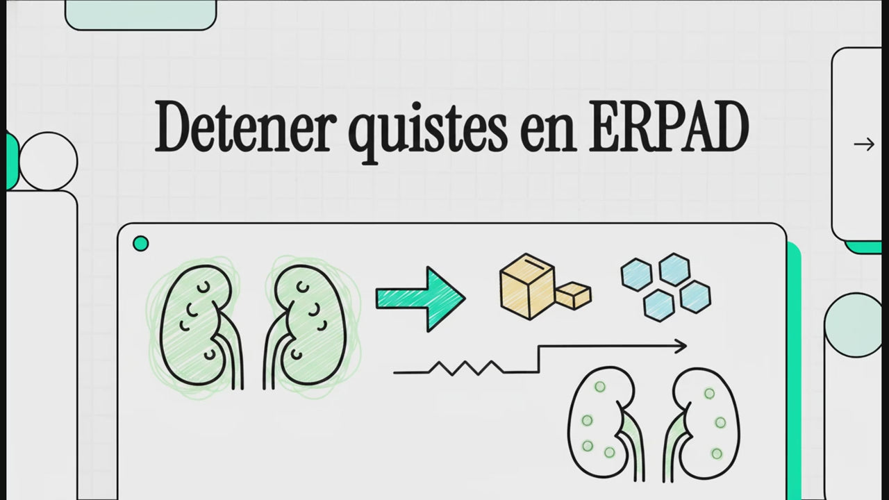 Cargar video: 